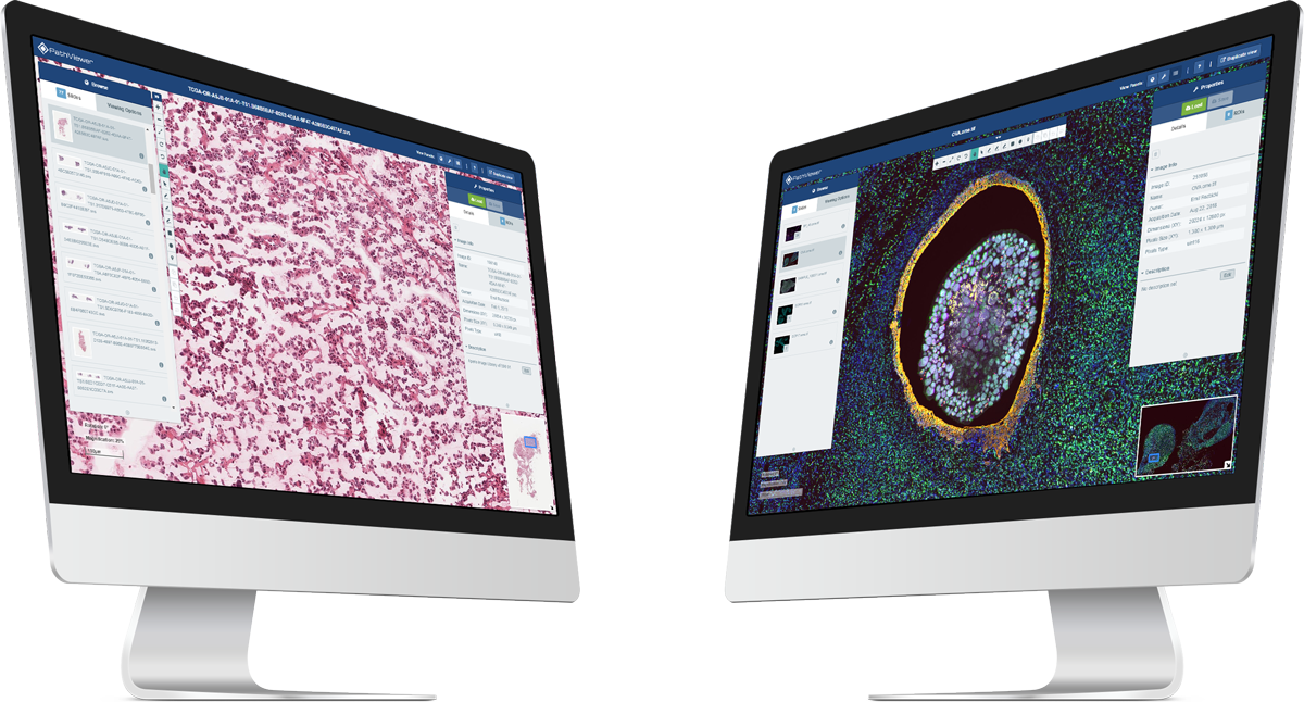 PathViewer, Glencoe Software’s Digital Pathology solution, displayed on dual monitors showing digital pathology and fluorescence images